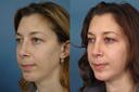 Non Surgical 10