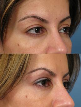 NonSurg1