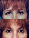 eye7