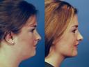 Neck 3