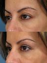 Non Surgical 2