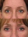 Non Surgical 7