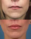 Non Surgical 8