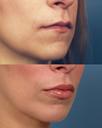 Non Surgical 9