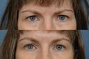 Non Surgical 18