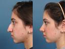 Nose9