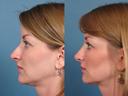 Nose24