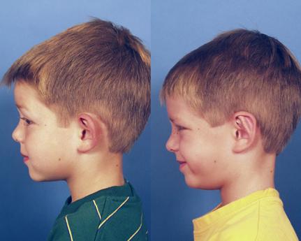 Ear 3