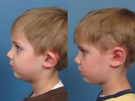 Ear 9