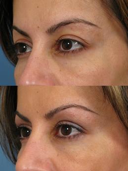 Non Surgical 2