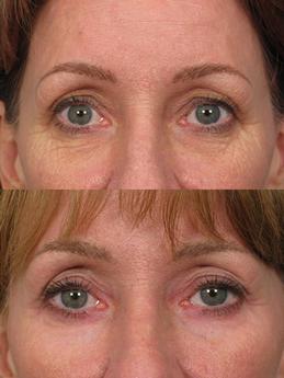 Non Surgical 7