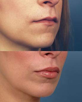 Non Surgical 9